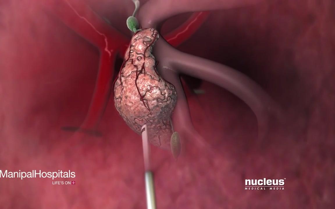 太阳成tyc7111cc官网